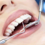 Choosing Toothpaste Amounts And Routines For Children With Limited Spitting Control