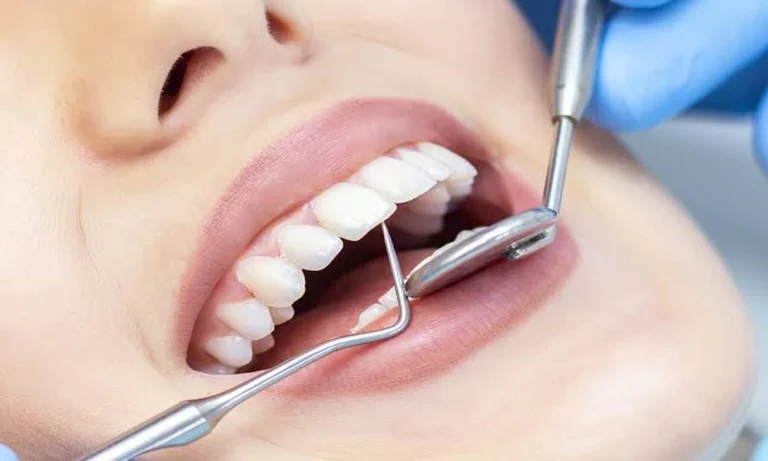 Choosing Toothpaste Amounts And Routines For Children With Limited Spitting Control