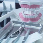 5 Benefits Of Choosing An Orthodontist Over DIY Aligners